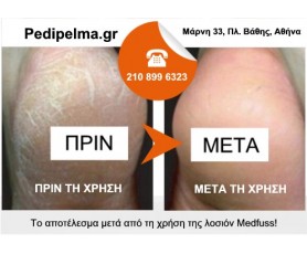 MEDFUSS - Λοσιόν Άμεσης Απομάκρυνσης Σκληρυνσεων Φτέρνας / Πέλματος Αφαιρεί την αντιαισθητικη κεράτινη στοιβάδα Χωρίς λίμες ελαφρόπετρες τρίψιμο και πόνο!