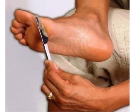 MEDFUSS - Λοσιόν Άμεσης Απομάκρυνσης Σκληρυνσεων Φτέρνας / Πέλματος Αφαιρεί την αντιαισθητικη κεράτινη στοιβάδα Χωρίς λίμες ελαφρόπετρες τρίψιμο και πόνο!